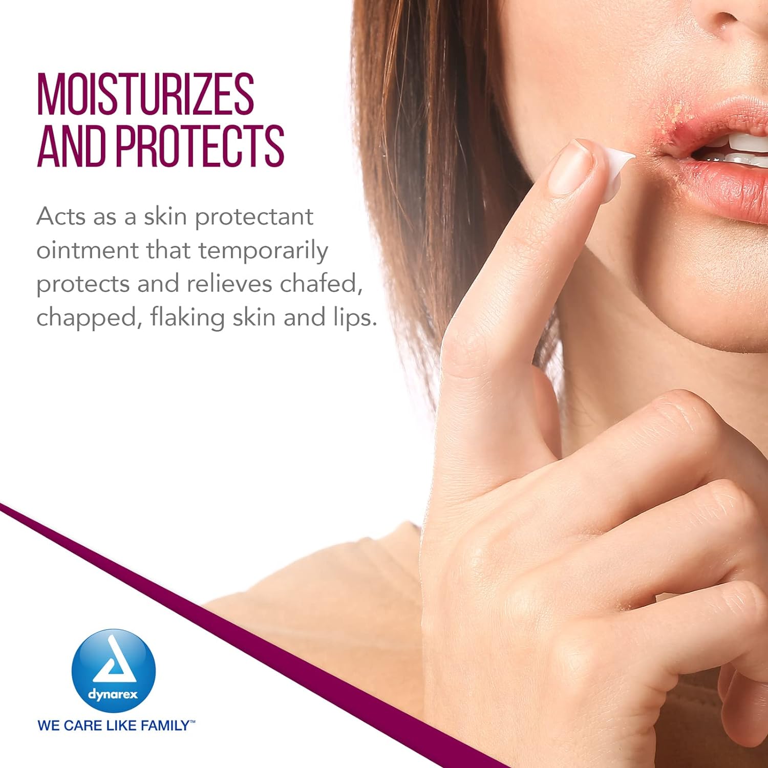 Dynarex White Petrolatum, Petroleum Jelly for Dry, Damaged or Cracked Skin, Soothing White Petroleum Jelly for Minor Skin Irritations, 15 oz. (425g) Jar, 1 Petroleum Jelly Jar