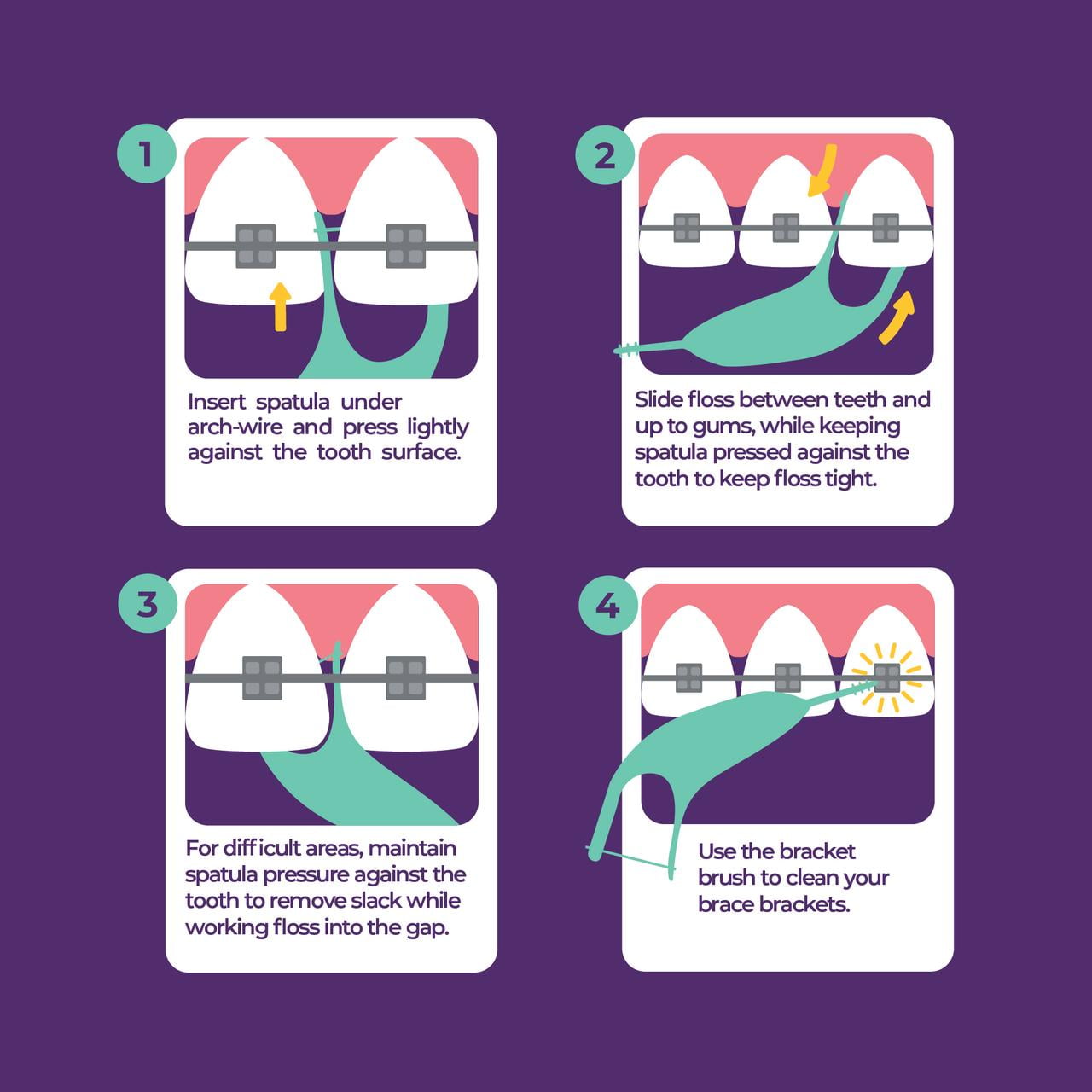 Platypus Orthodontic Flossers for Braces - Dental Floss Picks for Braces, Fits Under Arch Wire, Will Not Damage Braces, Increase Flossing Compliance, Floss Teeth in Less Than Two Minutes - 30 Count