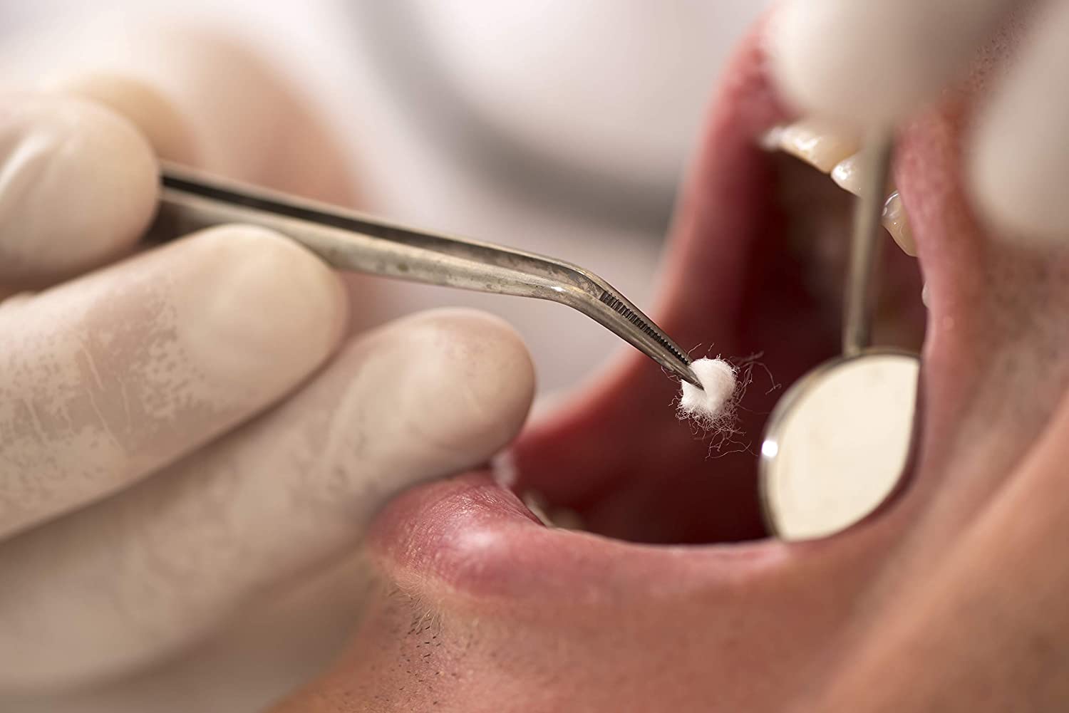 Richmond Dental & Medical 100108 Cotton Pellets, Size 3 (5/32" diameter)