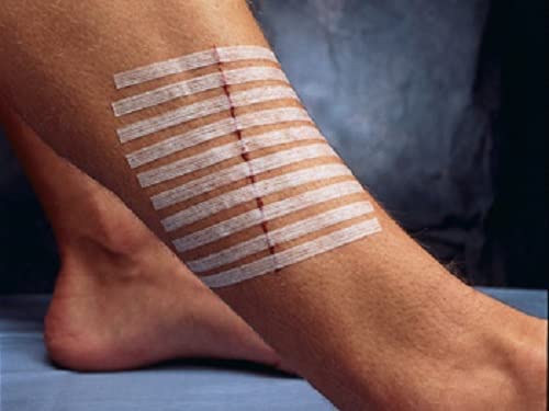 3M Steri Strips Reinforced Adhesive Skin Closures - 1/4" x 4" - Box