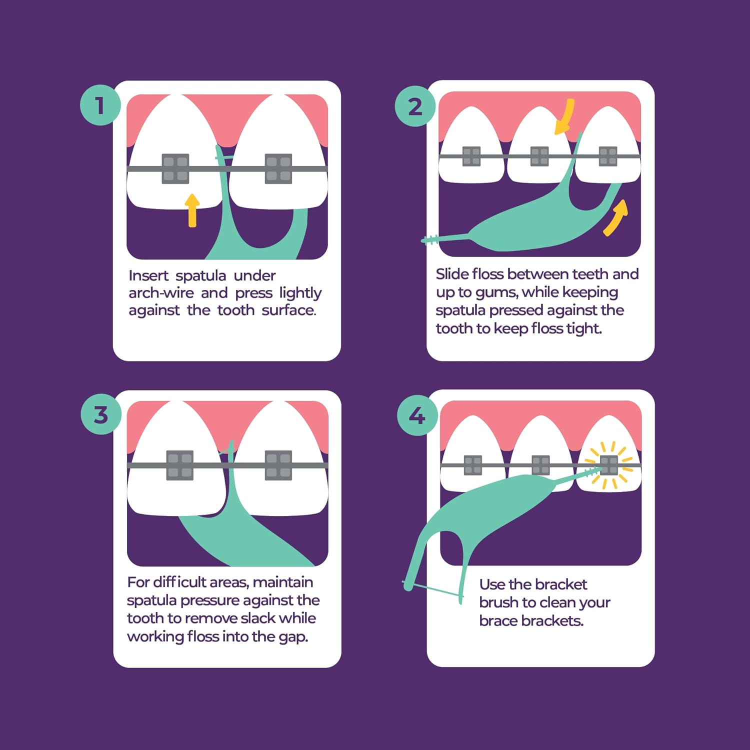 Platypus Orthodontic Flossers for Braces - Dental Floss Picks for Braces, Fits Under Arch Wire, Will Not Damage Braces, Increase Flossing Compliance, Floss Teeth in Less Than Two Minutes - 30 Count