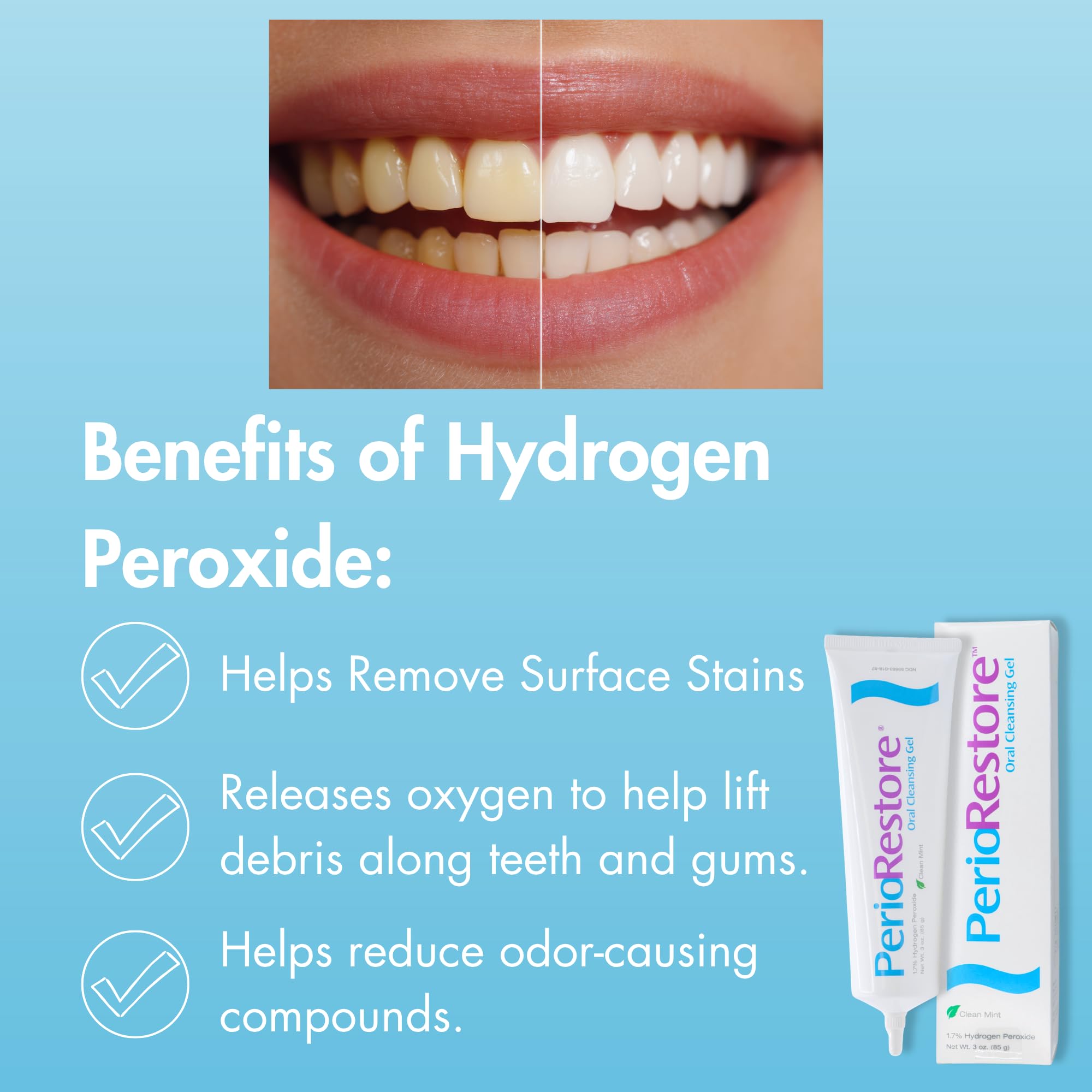 Perio Restore® Gel 3 Ounce Tube. 1.7% Hydrogen Peroxide Oral Cleansing Treatment Gel. Mint Flavor
